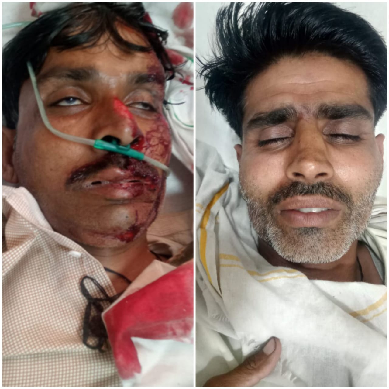 राजगढ़ः अलग-अलग जगह हुए सड़क हादसे में दो युवक घायल, हालत गंभीर