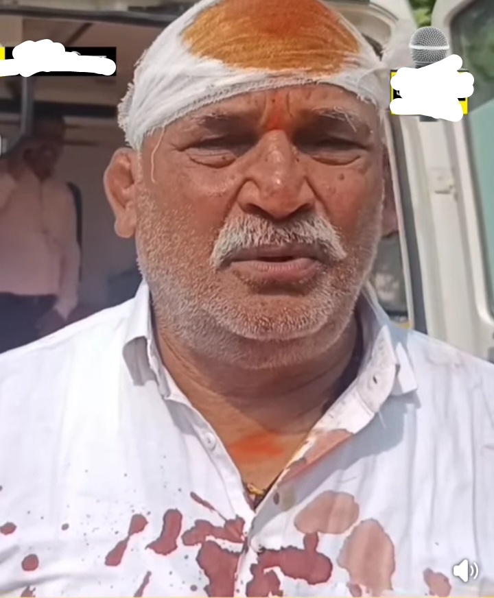 भूमि विवाद को चली गोलियां ,फोड़ा जमीन मालिक का सर