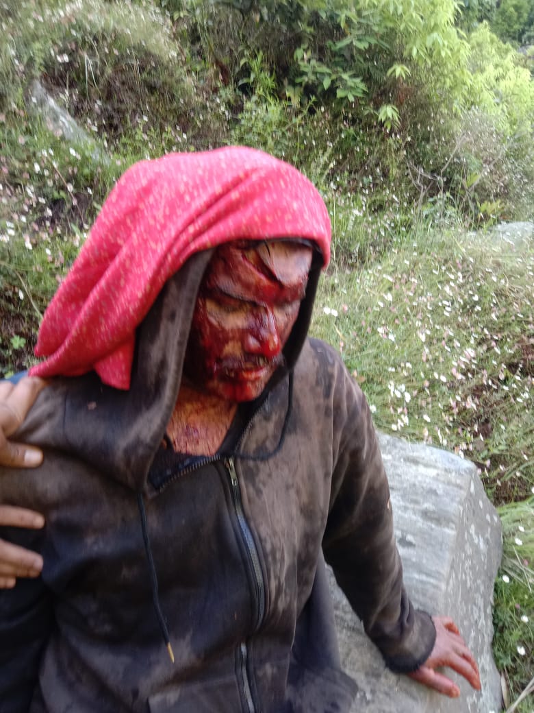 सिरमौर के घंडूरी गांव में जंगली भालू का हमला, व्यक्ति गंभीर रूप से घायल