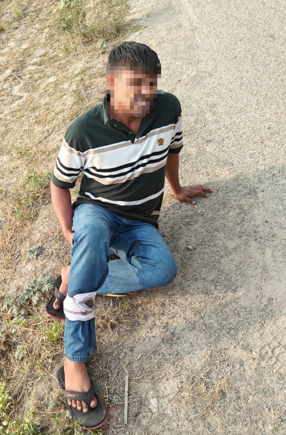 घायल बदमाश घायल बदमाश