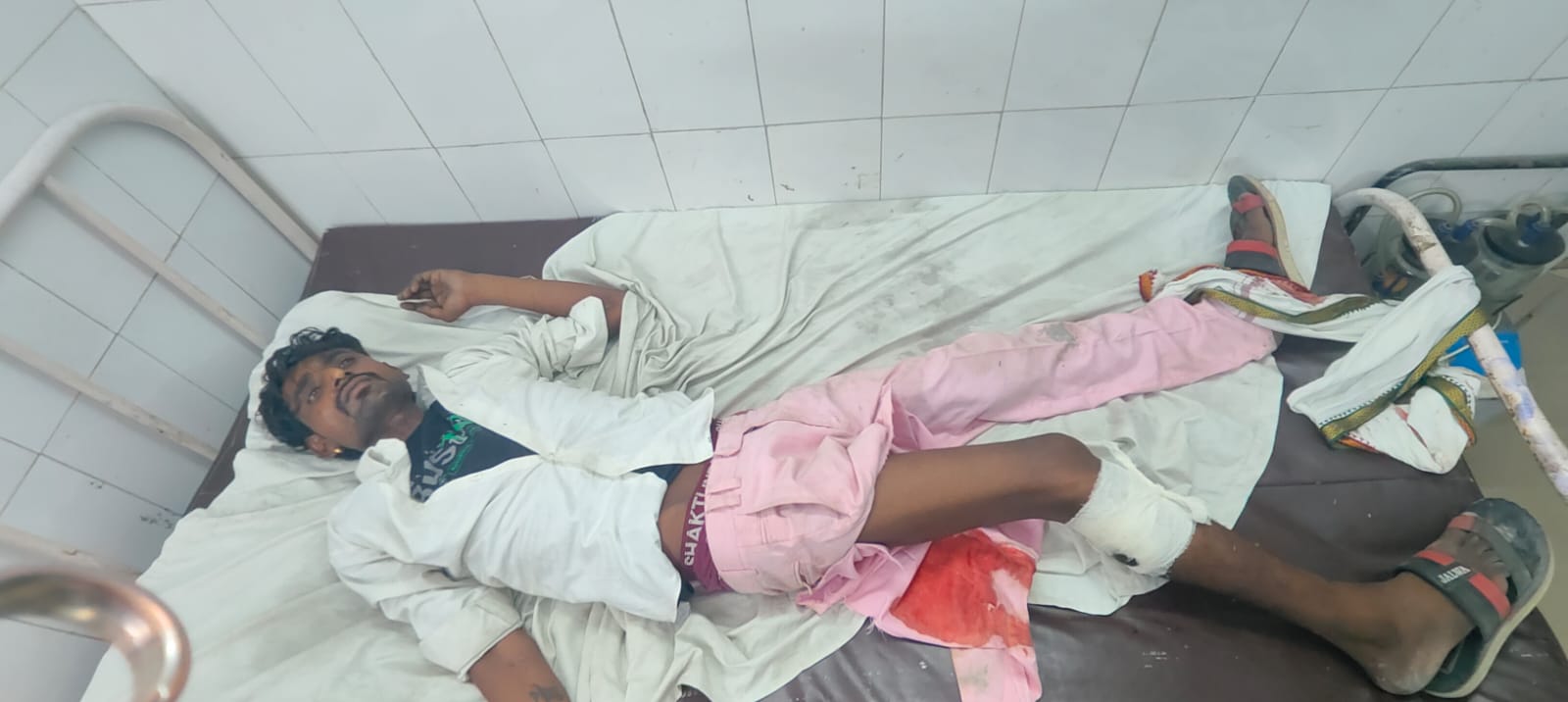 पुलिस मुठभेड़ में शातिर चोर के पैर में लगी गोली