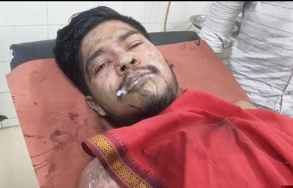 स्कॉर्पियो की टक्कर से बाइक सवार तीन युवक एसिड से झुलसे