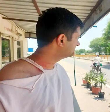 फरीदाबाद में वकील के परिवार से मारपीट,बहन को अगवा करने की कोशिश