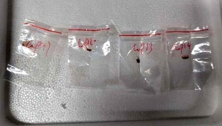 अमेरिका में जहरीले फंगस की तस्करी के आरोप में चीन की वैज्ञानिक गिरफ्तार